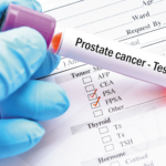 Is Prostate Cancer Curable?