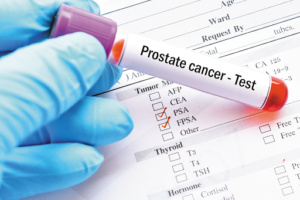 Is Prostate Cancer Curable?